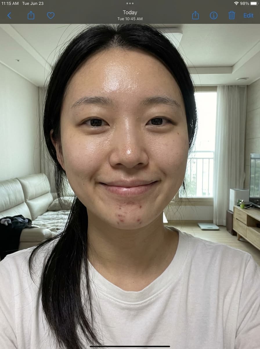 Before K-beauty transformation